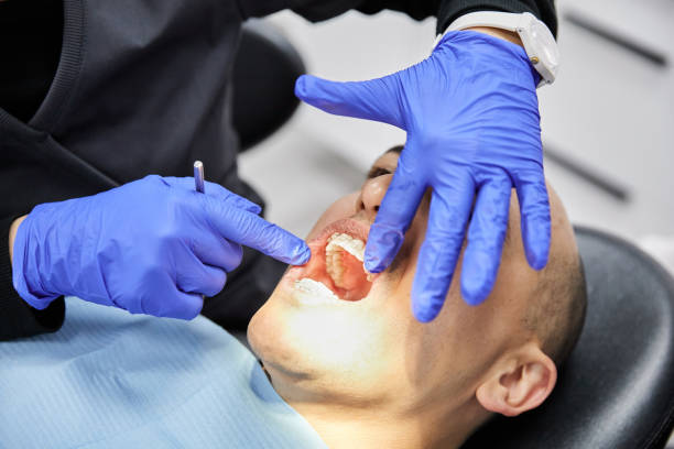 Best Emergency Root Canal Therapy in Bellwood, VA