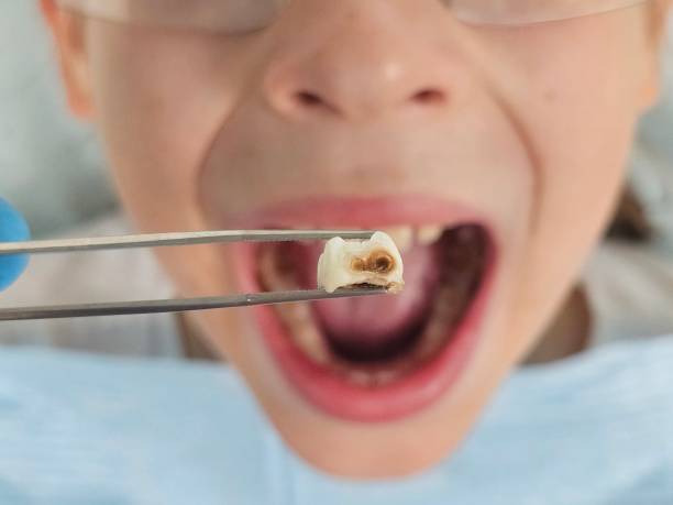 Best Emergency Care for Gum Disease in Bellwood, VA